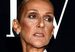 Celine Dion teria perdido controle dos músculos devido doença rara 
